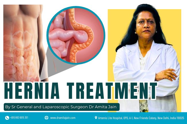Dr Amita Jain top hernia surgeon in Delhi Dr Amita Jain top hernia surgeon in Delhi